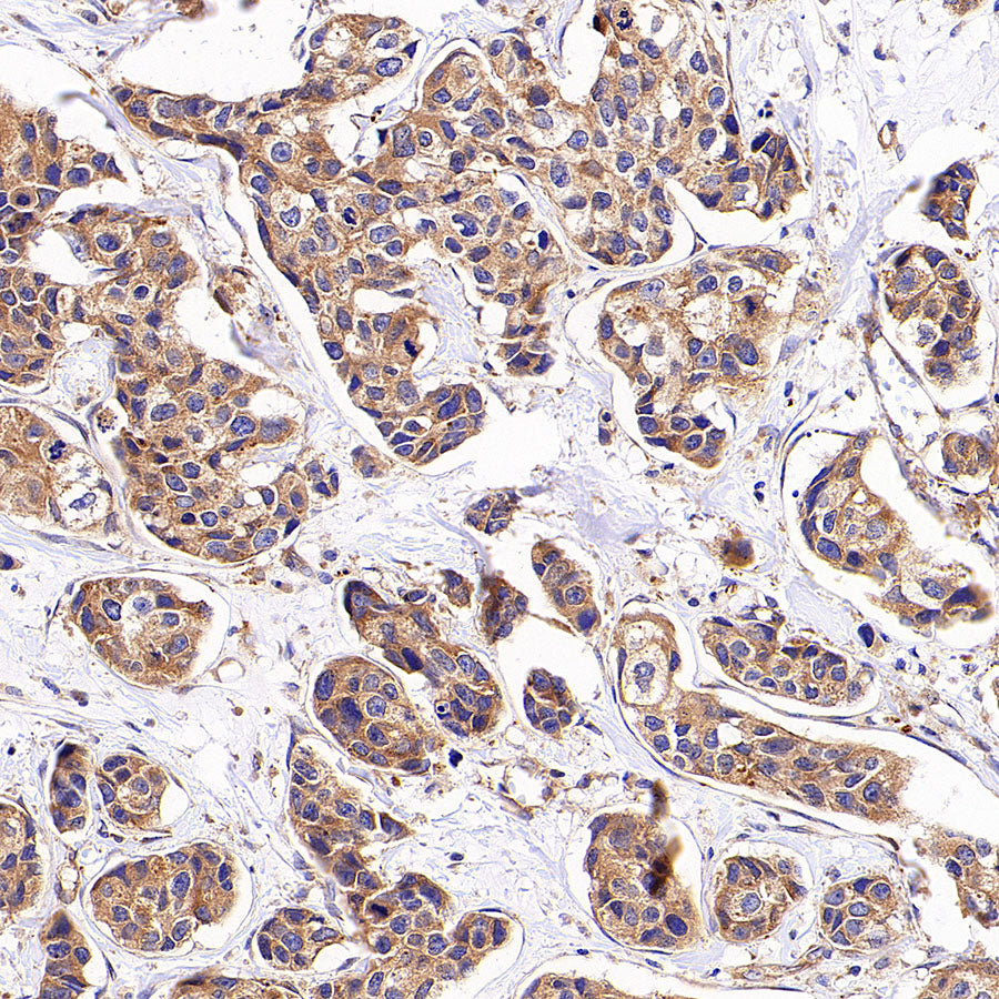 AP-2α Recombinant Rabbit mAb (S-4444-44)