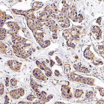 AP-2α Recombinant Rabbit mAb (S-4444-44)