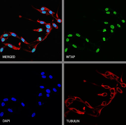 WTAP Recombinant Rabbit mAb (S-2741-49)