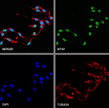 WTAP Recombinant Rabbit mAb (S-2741-49)