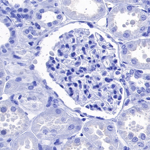 S-RMab® Cadherin 17 Recombinant Rabbit mAb (SDT-736-23)