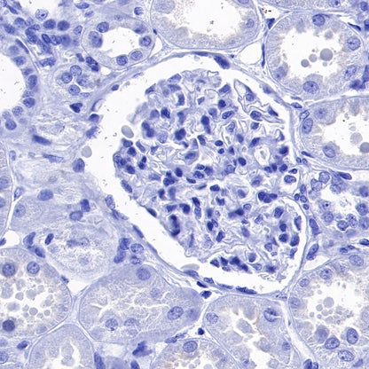 S-RMab® Cadherin 17 Recombinant Rabbit mAb (SDT-736-23)