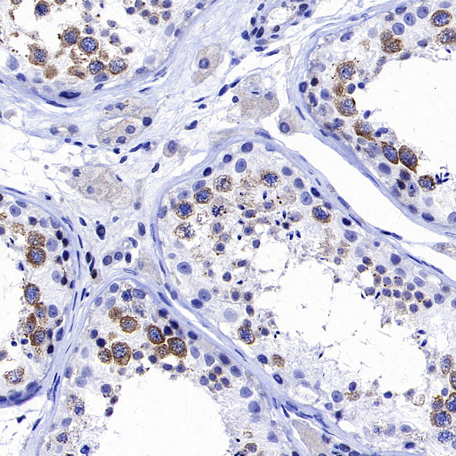 YTHDC2 Recombinant Rabbit mAb (S-3338-41)