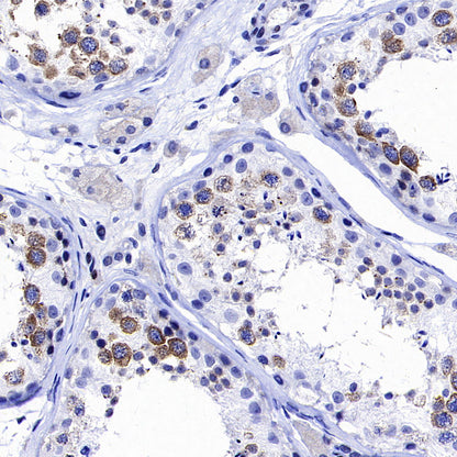 YTHDC2 Recombinant Rabbit mAb (S-3338-41)
