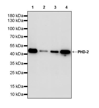 PHD-2 Recombinant Rabbit mAb (S-4111-17)