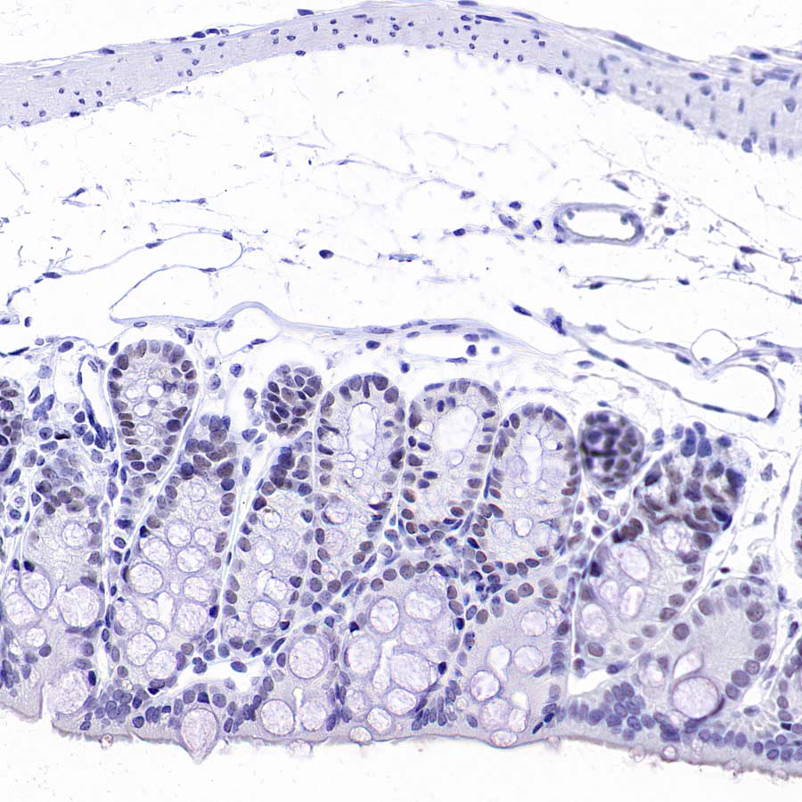 DGCR8 Recombinant Rabbit mAb (S-4082-6)