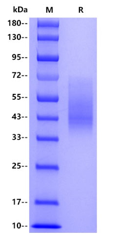 Human CD86, His tag