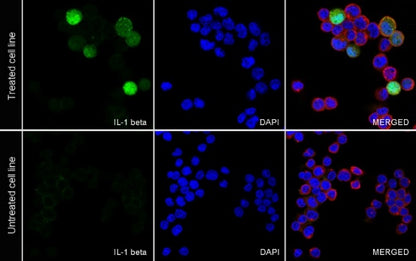 IL-1 beta Recombinant Rabbit mAb (S-3173)