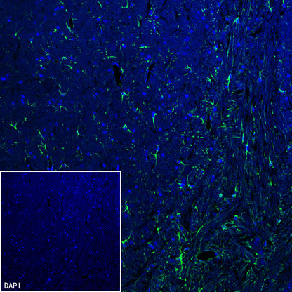GFAP Recombinant Rabbit mAb (Alexa Fluor® 488 Conjugate) (SDT-306-10)