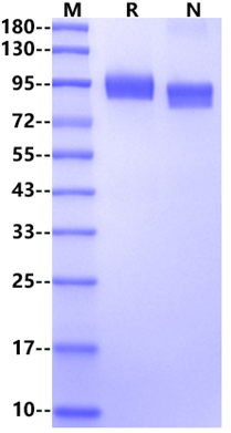 CD31/PECAM-1 His Tag Protein, Human