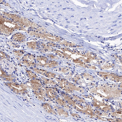 KRAS Recombinant Rabbit mAb (S-443-69)