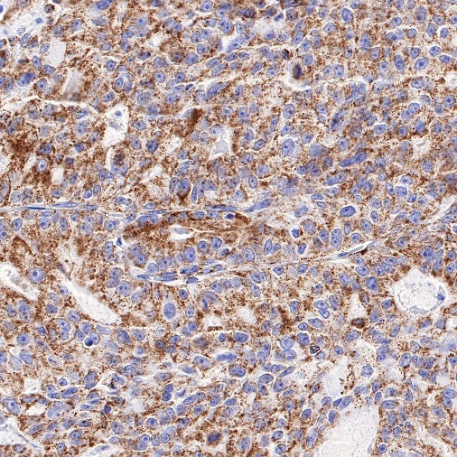 PTP1B Recombinant Rabbit mAb (S-R336)