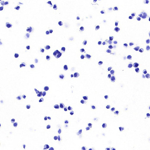 STEAP3 Recombinant Rabbit mAb (S-4466-26)