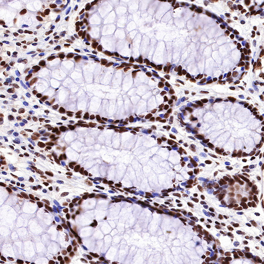 HDAC1 Recombinant Rabbit mAb (SDT-310-72)