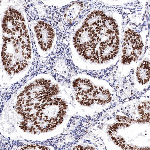 Topoisomerase I/TOP1 Recombinant Rabbit mAb (S-822-60)