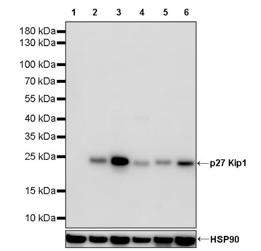 p27 Kip1 Recombinant Rabbit mAb (SDT-361-310)