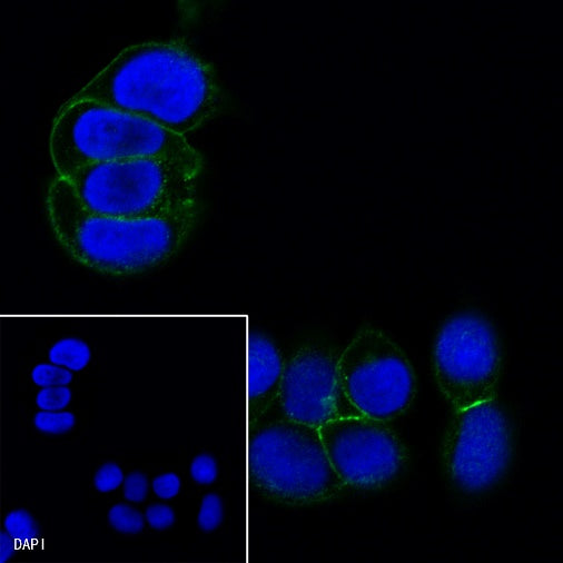 S-RMab® E-Cadherin Recombinant Rabbit mAb (SDT-438-5)