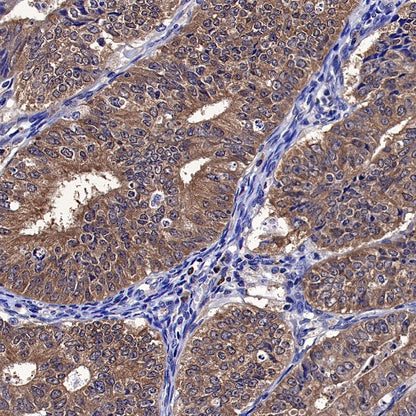 MIF Recombinant Rabbit mAb (S-1007-34)