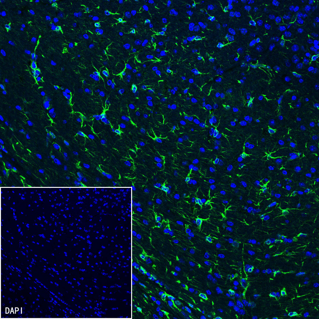GFAP Recombinant Rabbit mAb (SDT-306-10)