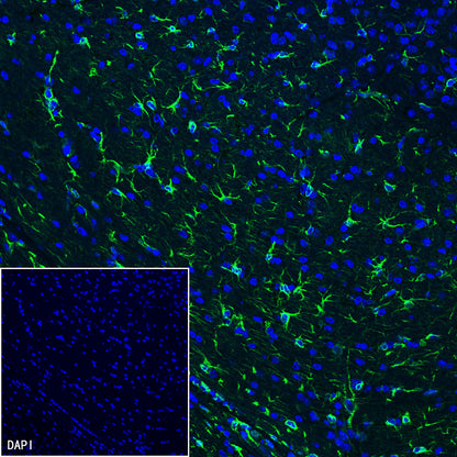 GFAP Recombinant Rabbit mAb (SDT-306-10)