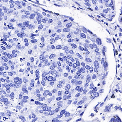 Uroplakin III Recombinant Rabbit mAb (SDT-R177)