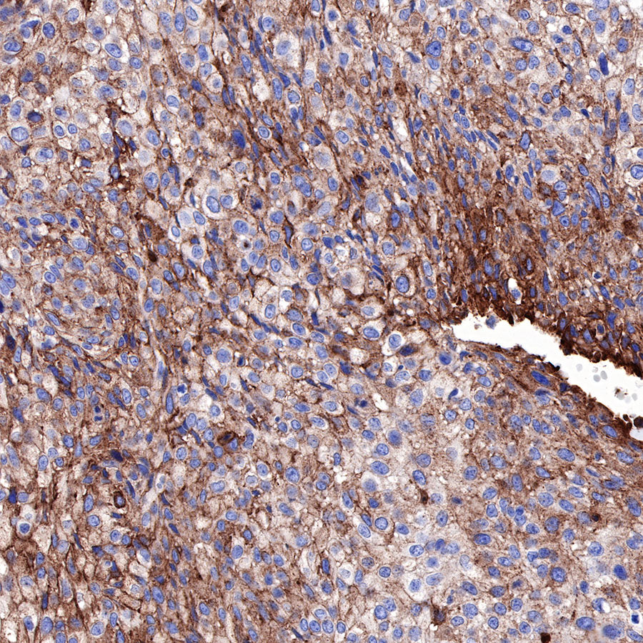 Caveolin-1 Recombinant Rabbit mAb (SDT-065-20)