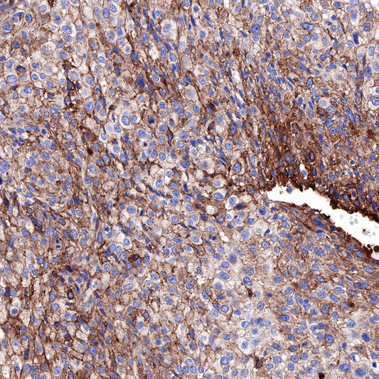 Caveolin-1 Recombinant Rabbit mAb (SDT-065-20)