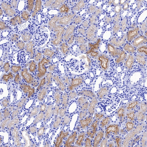 ENPP3/CD203c Recombinant Rabbit mAb (S-1632-11)
