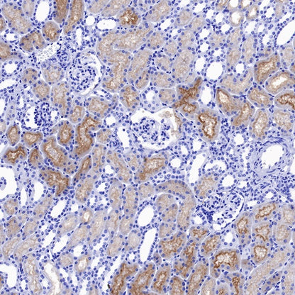 ENPP3/CD203c Recombinant Rabbit mAb (S-1632-11)