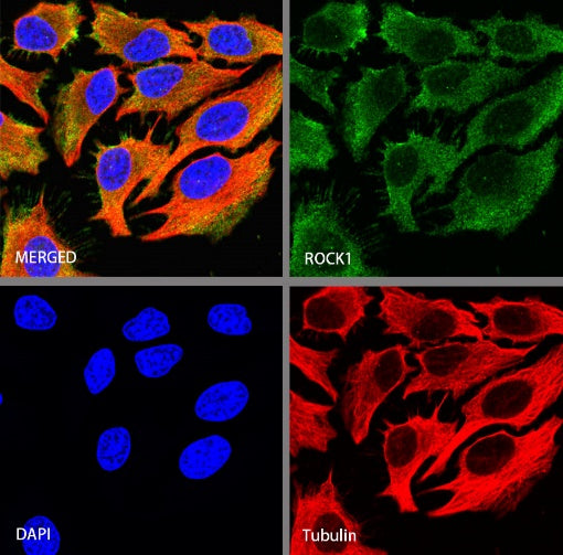ROCK1 Recombinant Rabbit mAb (S-1304-153)