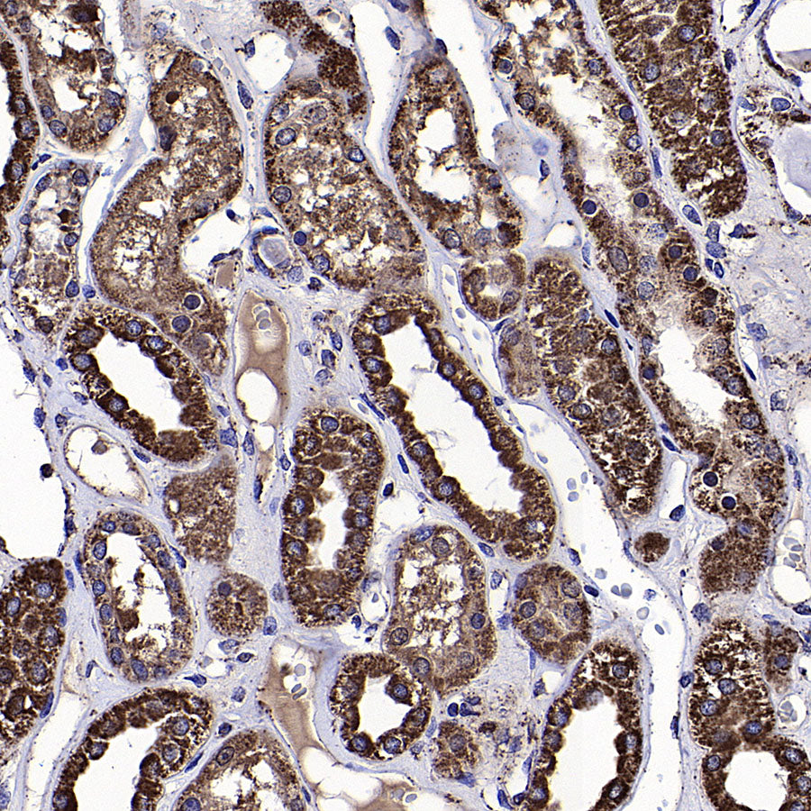 CYTB Recombinant Rabbit mAb (S-3877-15)