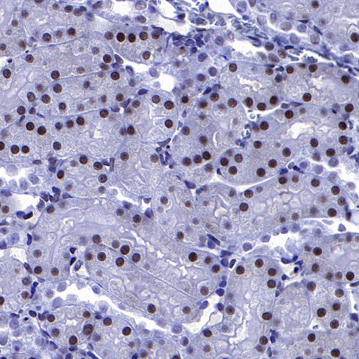 p27 Recombinant Rabbit mAb (S-141-135)