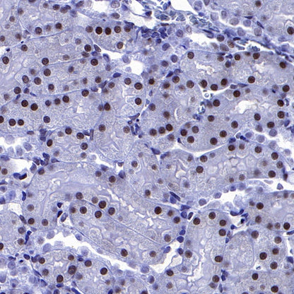 p27 Recombinant Rabbit mAb (S-141-135)