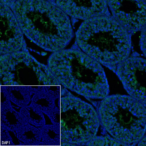 IFT88 Recombinant Rabbit mAb (S-2187-107)