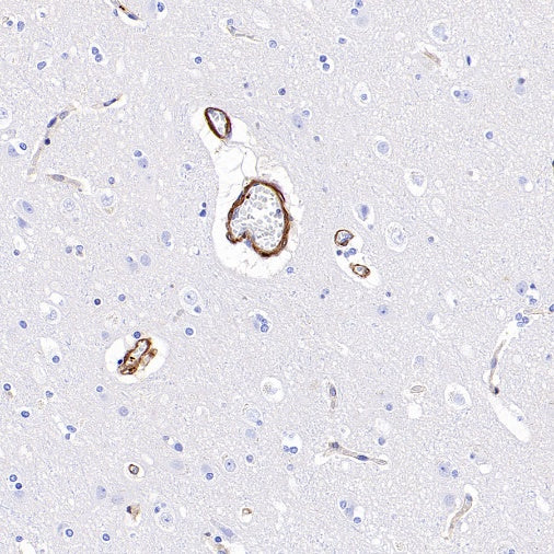Vinculin Recombinant Rabbit mAb (S-1635-3)