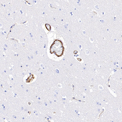 Vinculin Recombinant Rabbit mAb (S-1635-3)