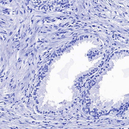 Cardiac Troponin I Recombinant Rabbit mAb (S-1352-28)