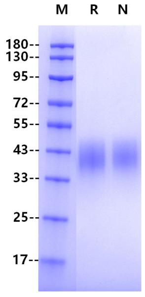 Fc γ RIIIa/CD16a(F176 Protein, S197P) His Tag Protein, Human