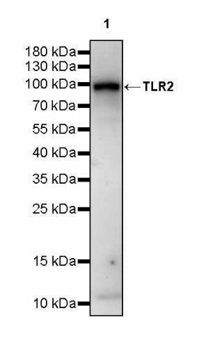 TLR2 Recombinant Rabbit mAb (S-2585-57)