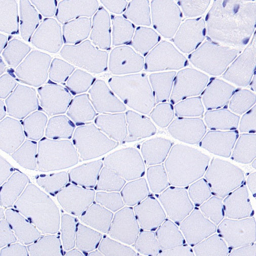 CBS Rabbit Polyclonal Antibody