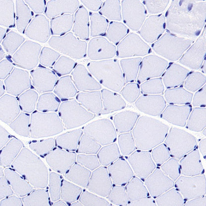 CBS Rabbit Polyclonal Antibody
