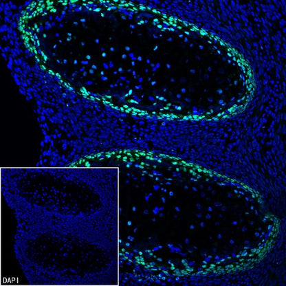 Sp7/Osterix Recombinant Rabbit mAb (SDT-3238-16)