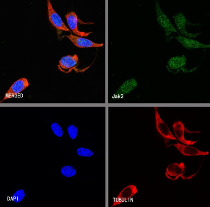 Jak2 Recombinant Rabbit mAb (S-1316-5)