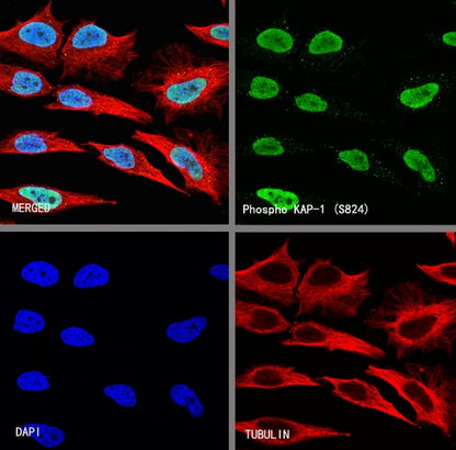 KAP-1 Recombinant Rabbit mAb (S-986-5)