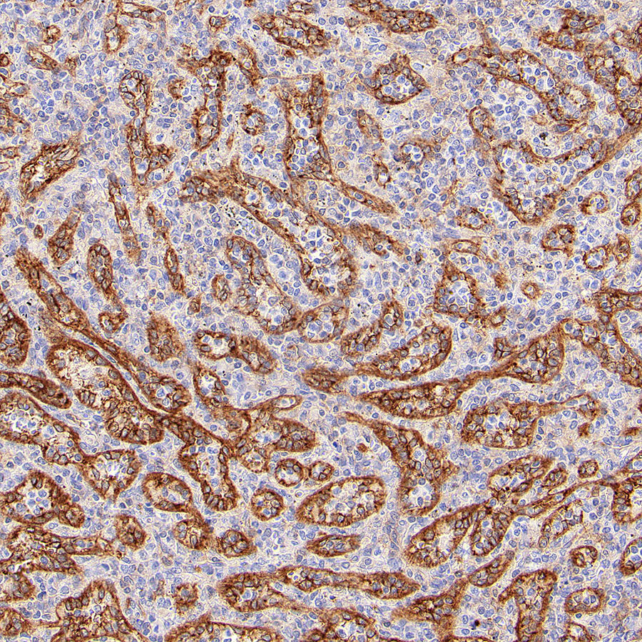 EPCR/PROCR (CD201) Rabbit Polyclonal Antibody