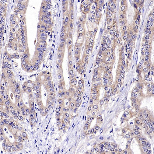 RIPK1 Rabbit Polyclonal Antibody