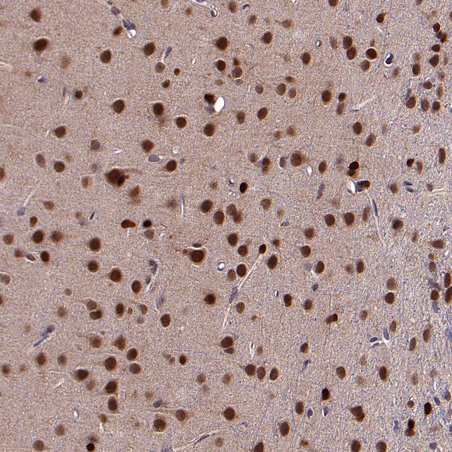 ACSS2 Recombinant Rabbit mAb (S-4117-9)