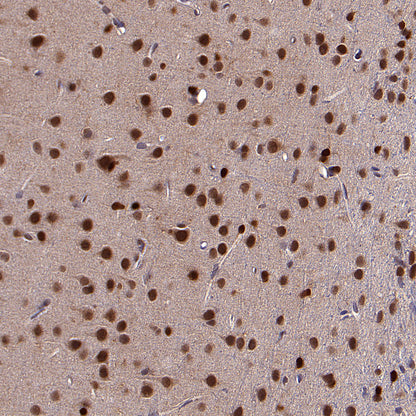 ACSS2 Recombinant Rabbit mAb (S-4117-9)