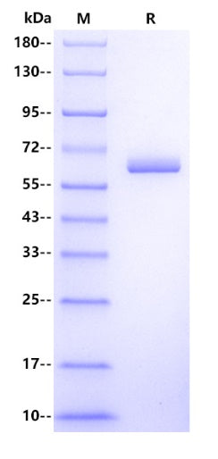Human ALPG/ALPPL2 Protein, His Tag