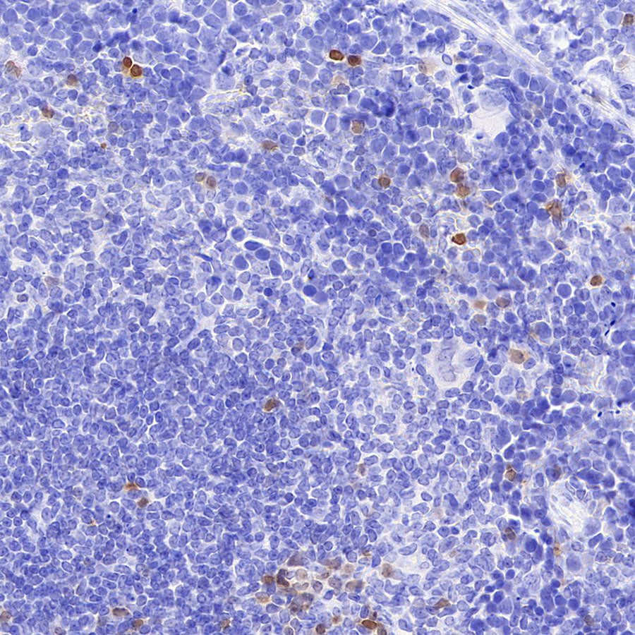 Stat4 Recombinant Rabbit mAb (S-4916-70)